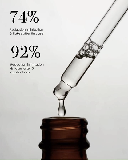 Dropper applying Seb Calming Serum with text showing 74% reduction in irritation and flakes after first use, 92% reduction after five applications.